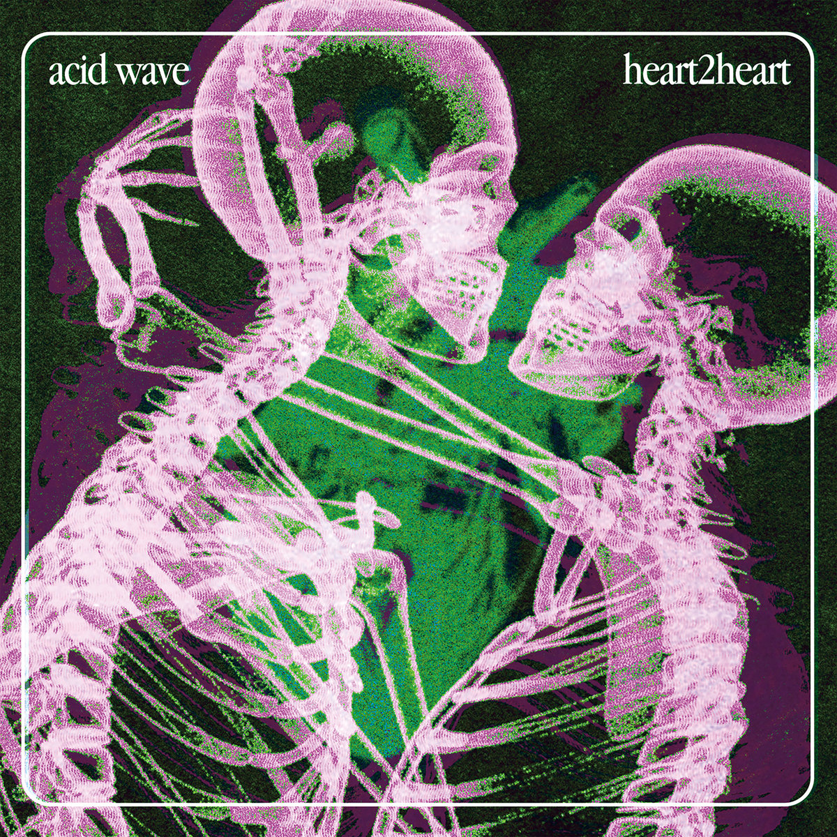 Listen Up – Acid Wave – Heart2heart